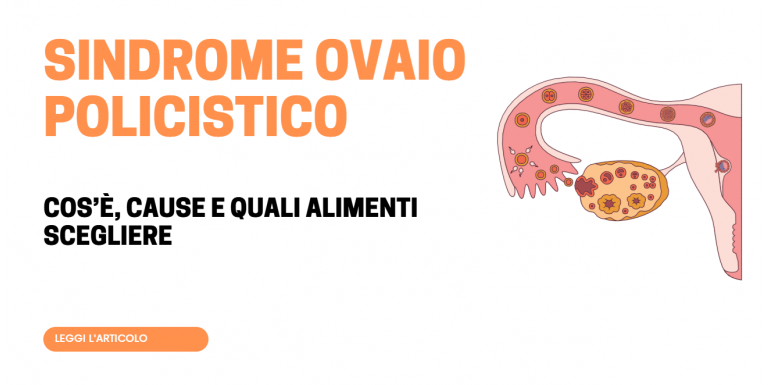 Ovaio policistico: cos'è, sintomi, cause e dieta secondo l'endocrinologa